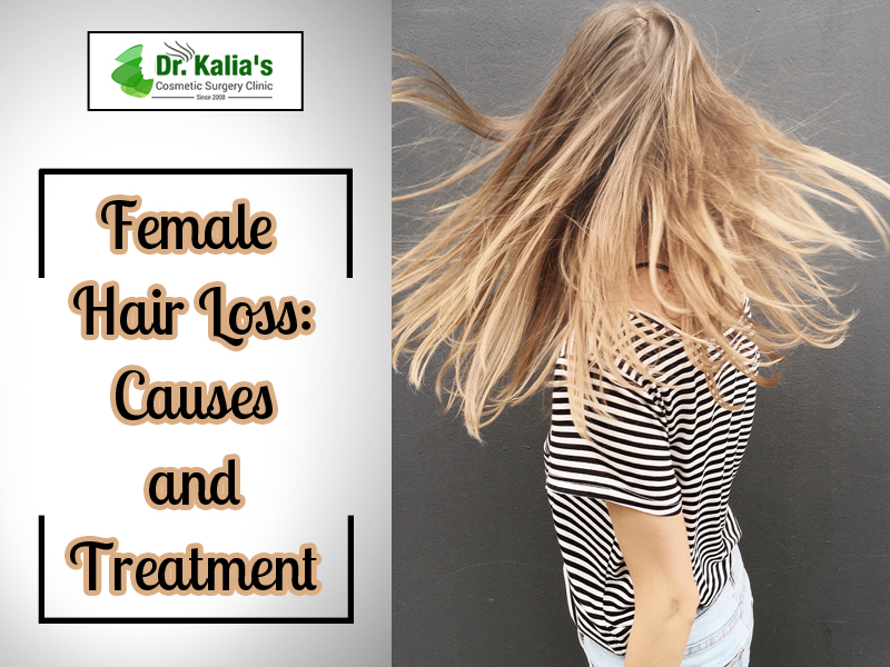 women hair loss treatments