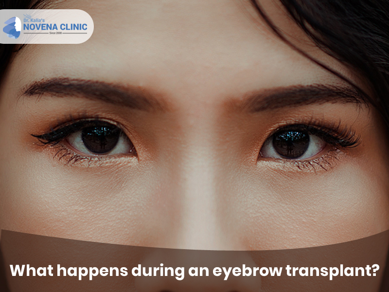 eyebrow transplant surgery