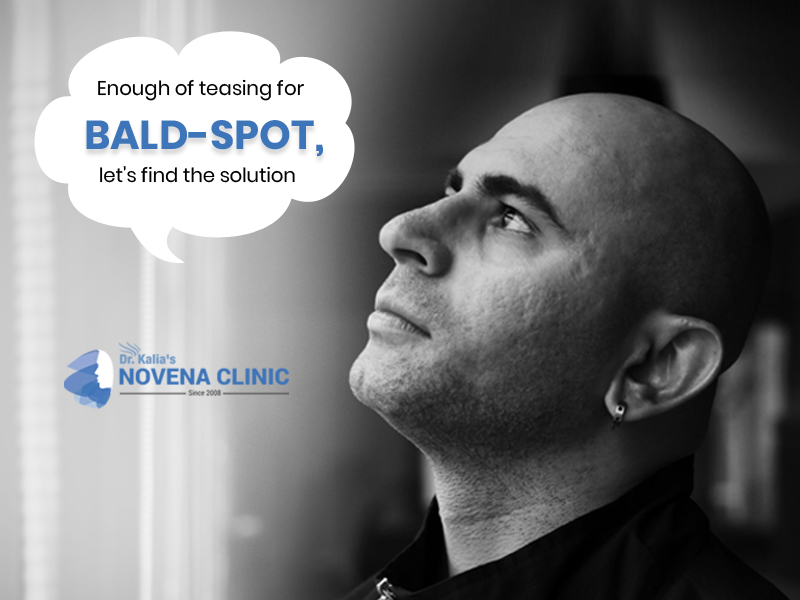 Hair transplant in India