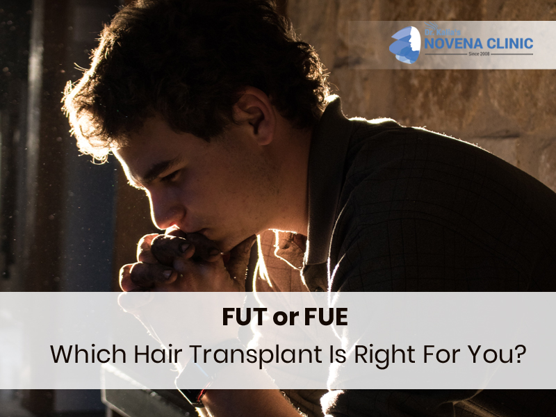 hair transplant in Chandigarh