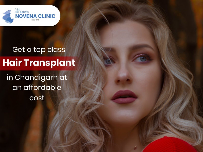 Hair Transplant in chandigarh